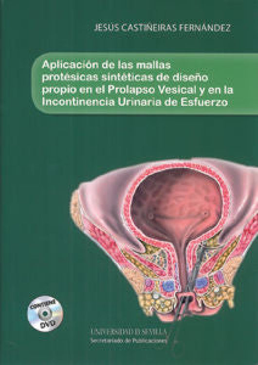 Aplicación De Las Mallas Protésicas Sintéticas Diseño Propio En El Prolapso Vesical Y La Incon Libro