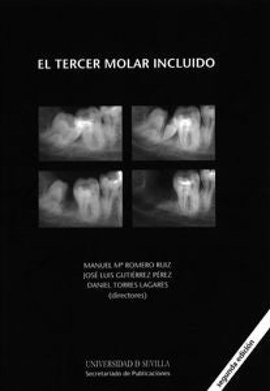 El Tercer Molar Incluido Libro