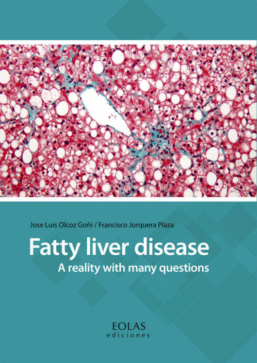 Fatty Liver Disease Libro