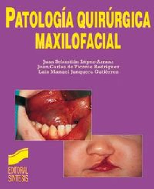 Patolog¡a Quirúrgica Maxilofacial Libro